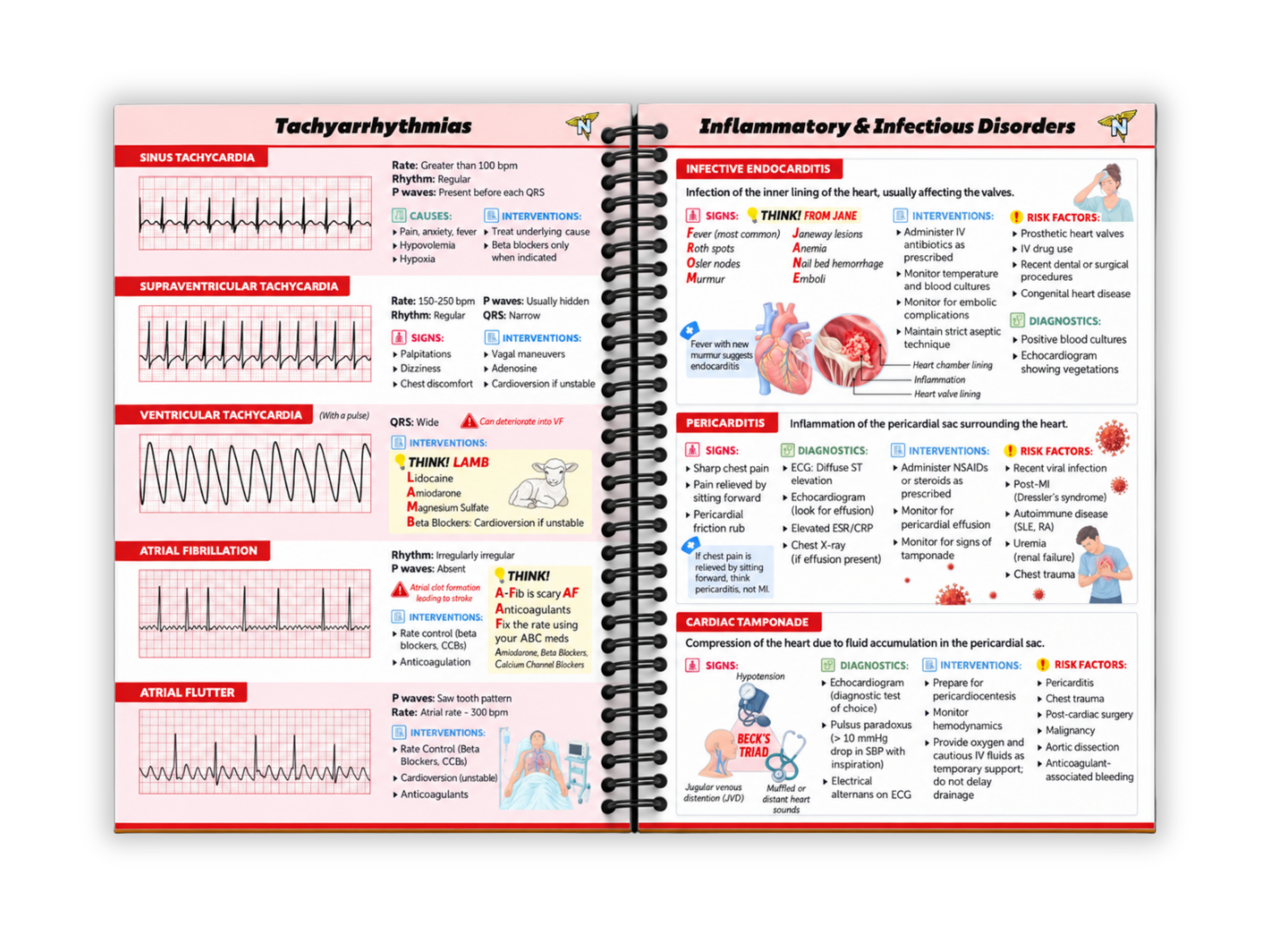 Open spread of the Complete NCLEX Bundle with NCLEX Tips